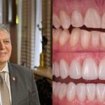 რა საერთო აქვთ კარიესს და გულის შეტევას? – კბილების გაფუჭება გულს აზიანებს — და შეიძლება სიცოცხლისთვის საფრთხეც იყოს