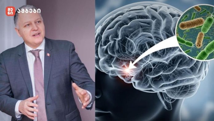 ახალი აღმოჩენა: ნაწლავის ორი ბაქტერია შესაძლოა იწვევდეს გაფანტულ სკლეროზს