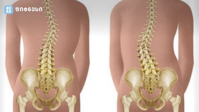 ისტორიული გარღვევა, რომელიც მილიონობით ადამიანს სიარულში დაეხმარება