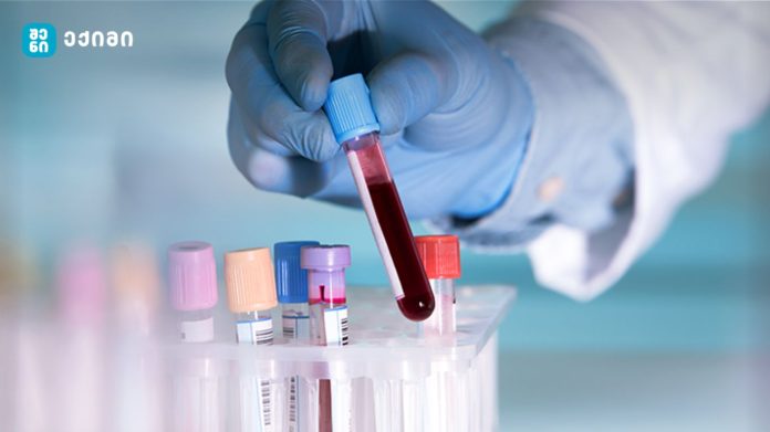 ტყვია თქვენს პროტეინის ფხვნილში! ახალი კვლევა აფრთხილებს მომხმარებლებს