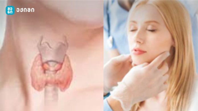 ფარისებრი ჯირკვლის დისფუნქციის 12 სიმპტომი, რომლებიც არასდროს უნდა იგნორირდეს