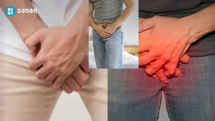 მისი მიზეზი მრავალი სხვადასხვა მდგომარეობა შეიძლება იყოს – გენიტალური ქავილი მამაკაცებში