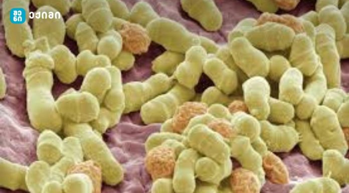 სოკოს ნიშნები ადამიანის ორგანიზმში - ყველაფერი, რაც ქავილს იწვევს, სოკოა?