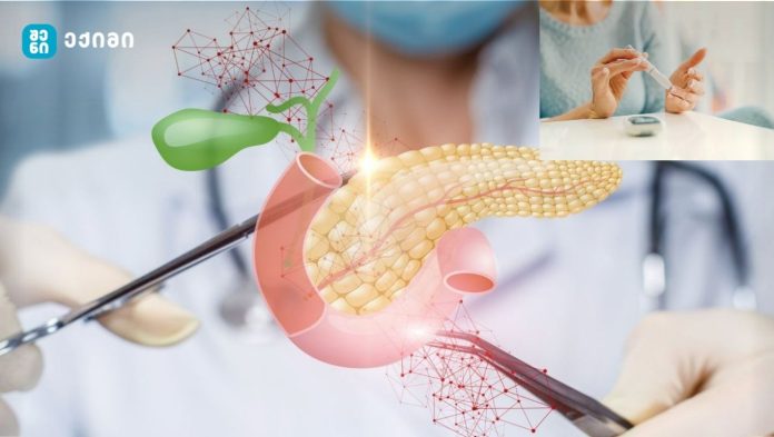 ისტორიული მიღწევა - მკვლევრებმა ღეროვანი უჯრედების გამოყენებით შექმნეს თერაპია, შეძლეს ფუნქციური პანკრეასის აღდგენა და სისხლში შაქრის ნორმალიზება