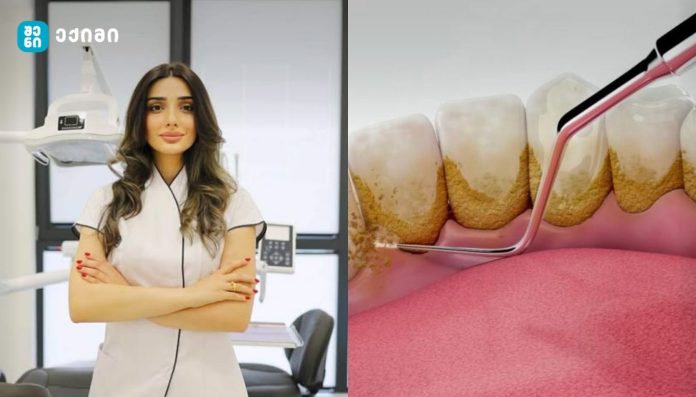 რატომ არის პირის ღრუს ჯანმრთელობა ორგანიზმისთვის კრიტიკულად მნიშვნელოვანი?