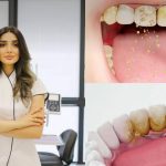 რატომ ვერ იწმინდება ნადების 80 % სახლში?