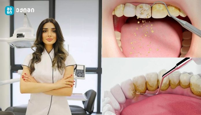 რატომ ვერ იწმინდება ნადების 80 % სახლში?