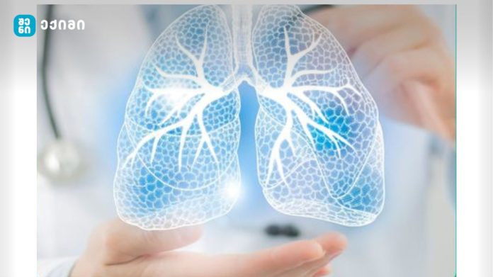 დემენცია წარმოადგენს პროგრესირებად ნევროლოგიურ სინდრომს, რომელიც გავლენას ახდენს მეხსიერებაზ