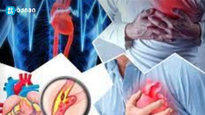 „სამწუხაროდ, მისი ასაკი თანდათან ახალგაზრდავდება – ასე შეიძლება აღმოაჩინოთ იშემიური ინსულტის რისკი” – ექიმი ირაკლი მიქაძე საინტერესო ინფორმაციას ავრცელებს