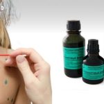 Close-up of a hand applying a green dot treat­ment on a person's back with a small brush, three dark bottles with teal labels nearby.
