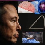 Side profile of a man with a glowing neural implant at the temple, overlaid with brain and neuroscience graphics, depicting brain–computer interfaces.