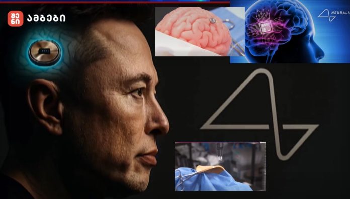 Side profile of a man with a glowing neural implant at the temple, overlaid with brain and neuroscience graphics, depicting brain–computer interfaces.