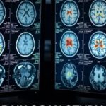 ADHD და ტვინი: მსოფლიოში ერთ-ერთმა ყველაზე დიდმა კვლევამ ნევროლოგიური განსხვავებების არსებობა დაადასტურა
