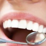 Close-up of a mouth during a dental checkup, showing white teeth and a dental mirror inside the open mouth.
