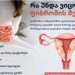 რა უნდა ვიცოდეთ ფიბრომის შესახებ? რა იწვევს საშვილოსნოს ფიბრომას?