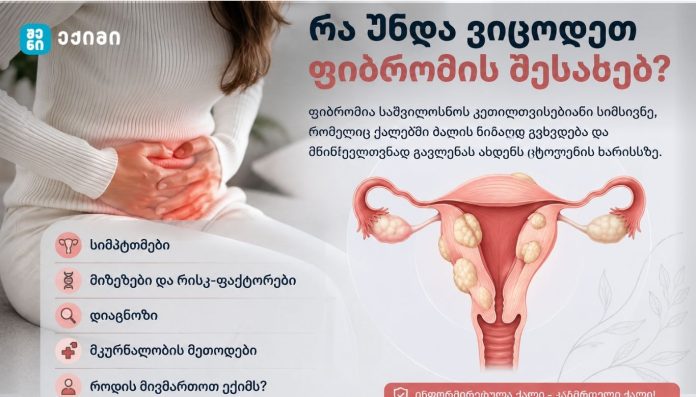 რა უნდა ვიცოდეთ ფიბრომის შესახებ? რა იწვევს საშვილოსნოს ფიბრომას?