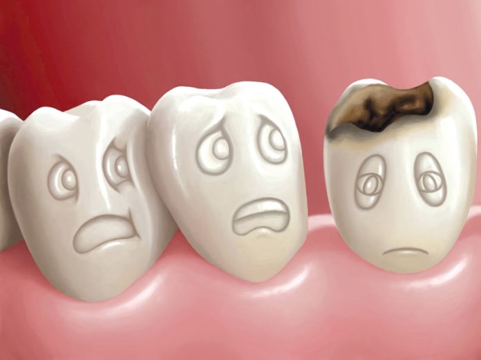 Row of molar teeth with cartoon faces looking worried, highlighting a tooth with a large cavity on the right.