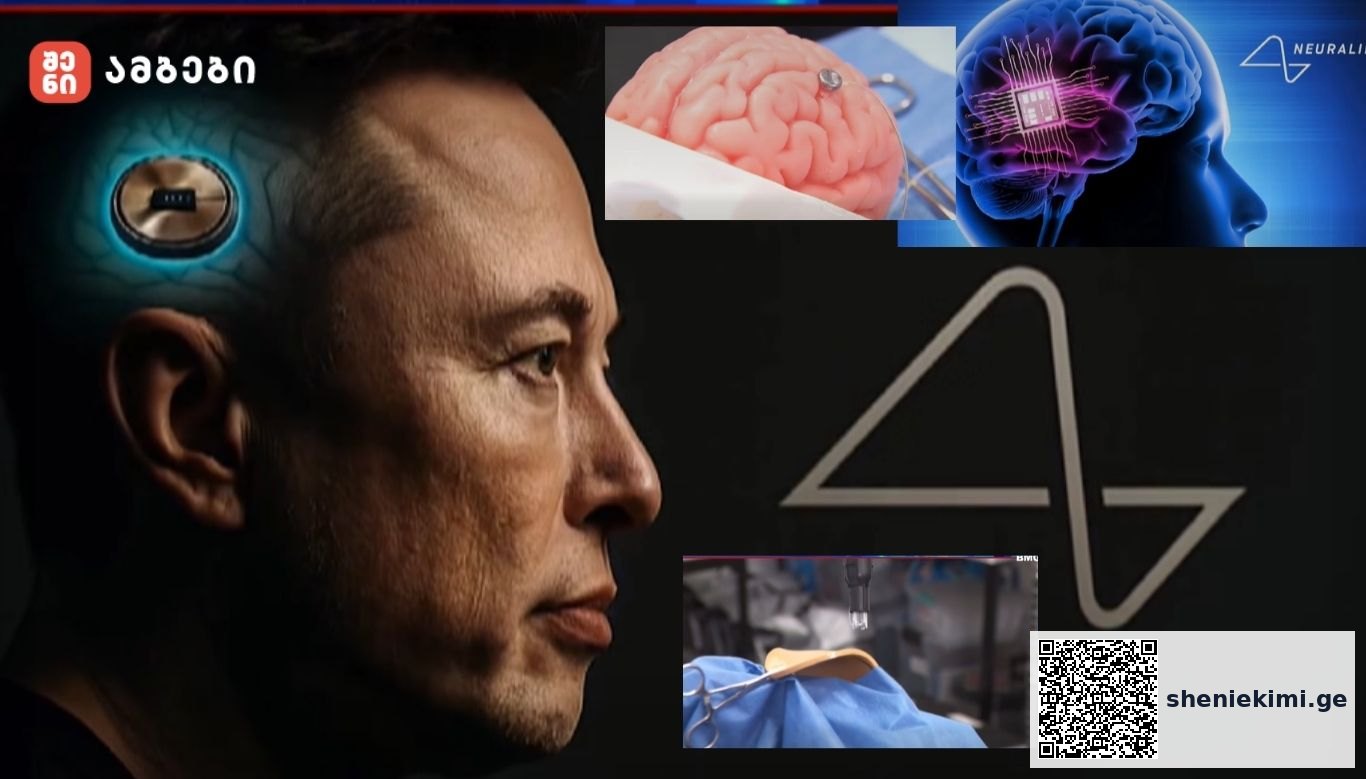 Side profile of a man with a glowing neural implant at the temple, overlaid with brain and neuroscience graphics, depicting brain–computer interfaces.