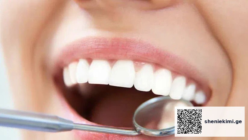Close-up of a mouth during a dental checkup, showing white teeth and a dental mirror inside the open mouth.