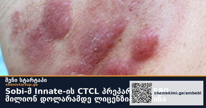 Sobi-მ Innate-ის CTCL პრეპარატზე 580 მილიონ დოლარამდე ლიცენზია შეიძინა