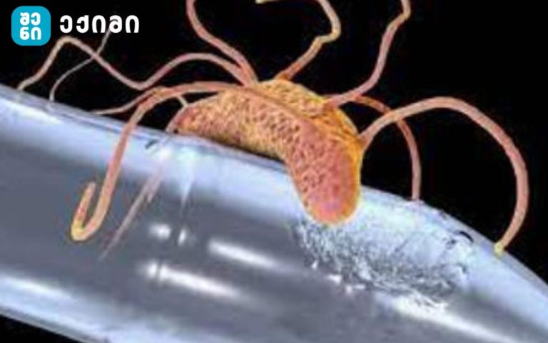 მეცნიერებმა შექმნეს ახალი ტიპის ბაქტერია, რომელიც პლასტმასის ნარჩენების გადამუშავებას უწყობს ხელს