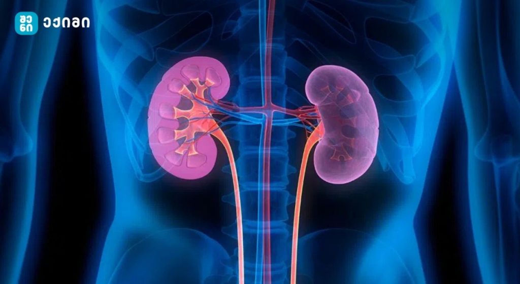 როგორ შევინარჩუნოთ მათი ჯანმრთელობა და ადრეულ ეტაპზე ამოვიცნოთ თირკმელების დაავადების ნიშნები