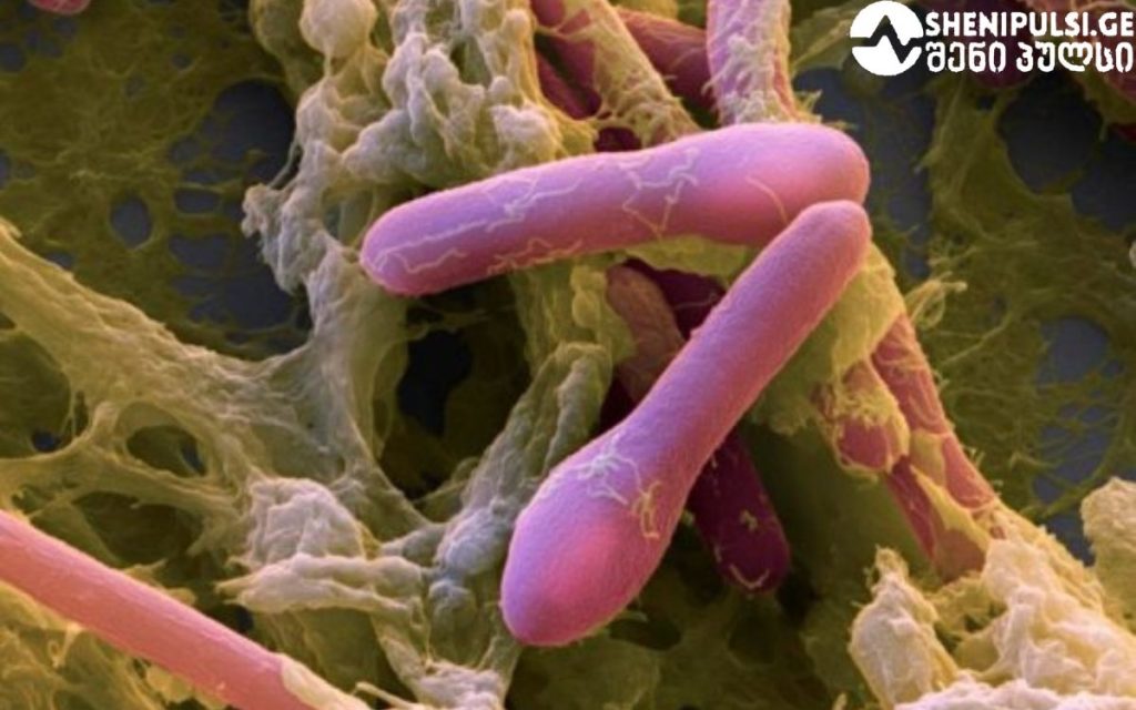 რამდენ ხანში ვლინდება სიმპტომები? სახლში დამზადებული ყველა კონსერვი საშიშია? – ბოტულიზმის დროს საათები გადამწყვეტია | sheniekimi.ge | შენი ექიმი