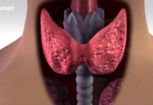 T3 და T4-ის მომატება: რას ნიშნავს და როგორ ვლინდება ჰიპერთირეოზი – რატომ აჩქარდება მეტაბოლიზმი და გულისცემა ფარისებრი