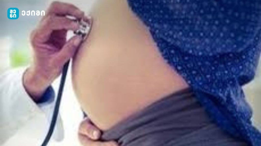 გაჭიანურებული ორსულობა (გახანგრძლივებული ორსულობა) – ორსულობა, რომელიც გრძელდება 42 კვირაზე მეტს