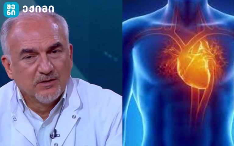 კარდიომიოპათიის შემთხვევები კოვიდ19-ის შემდეგ