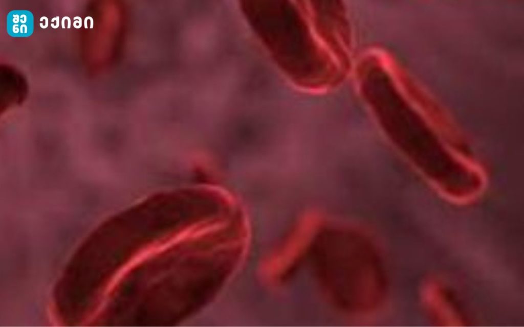 ჰემობლასტოზი არის სიმსივნური დაავადებების ჯგუფი, რომელიც ხასიათდება სისხლის წარმომქმნელი ქსოვილებისგან ავთვისებიანი სიმსივნეების წარმოქმნით