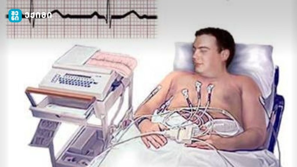 ელექტროკარდიოგრაფია (ECG/EKG) - ყველაფერი, რაც უნდა იცოდეთ, რას წარმოადგენს და როგორ მუშაობს – საინფორმაციო ბუკლეტები | შენი ექიმი