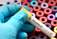 ჰეპატიტის მართვა – საინფორმაციო ბუკლეტი (ინფექციური დაავადებები)