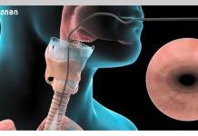 ბრონქოსკოპია: ფილტვებისა და სასუნთქი გზების გამოკვლევა- საინფორმაციო ბუკლეტი (რესპირატორული ჯანმრთელობა)