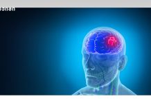 ინსულტის შემდგომი რეაბილიტაცია – საინფორმაციო ბუკლეტი (რეაბილიტაცია და ფიზიოთერაპია)