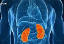 თირკმლის კიბოს კლინიკური ნიშნები, რომელთა ცოდნაც მნიშვნელოვანია