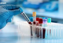 სისხლის ანალიზები – საინფორმაციო ბუკლეტი (დიაგნოსტიკა)