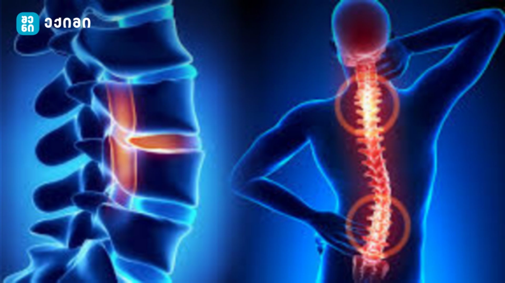 shenieqimi osteoporozi