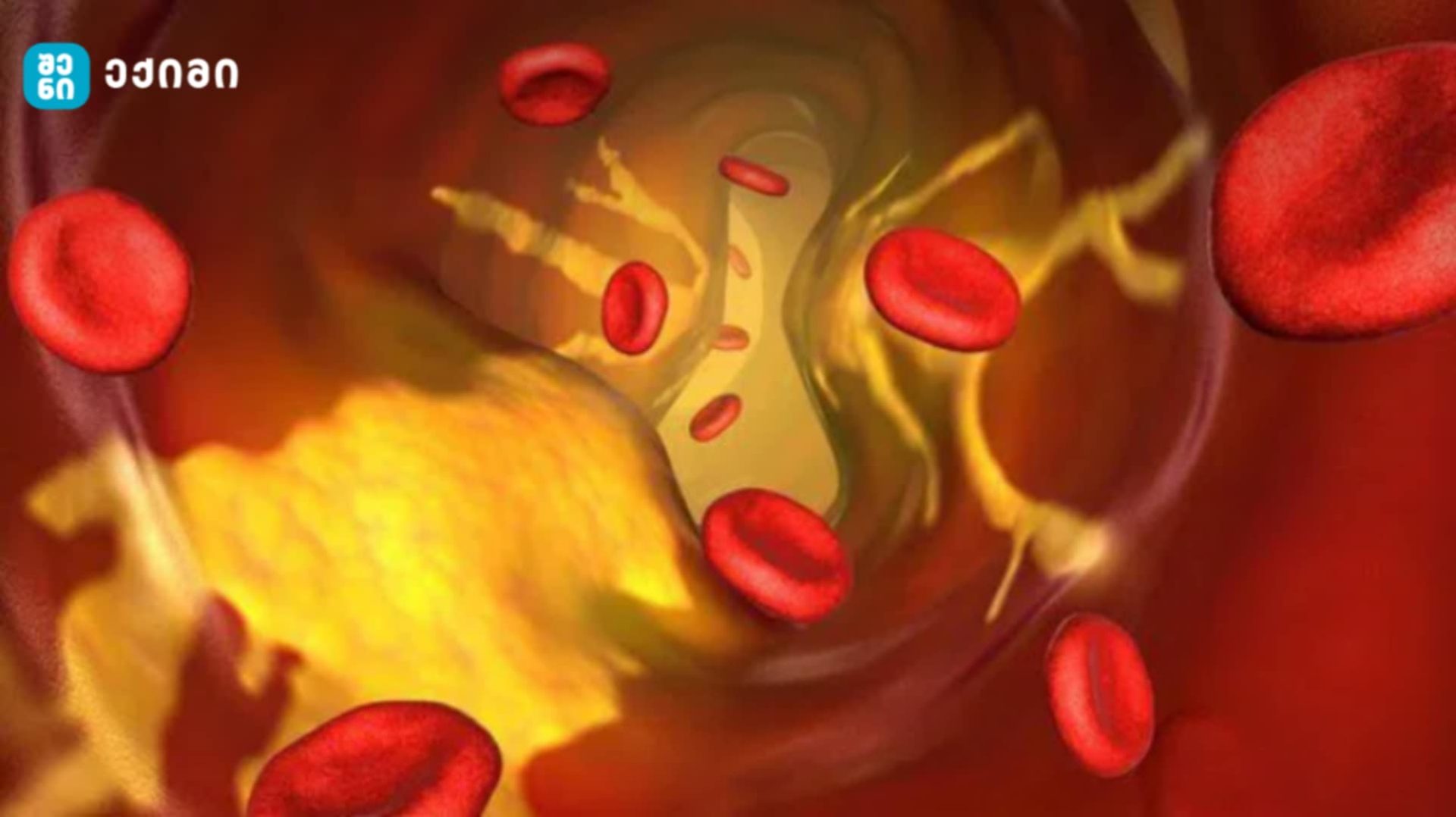 shenieqimi qolestrenili