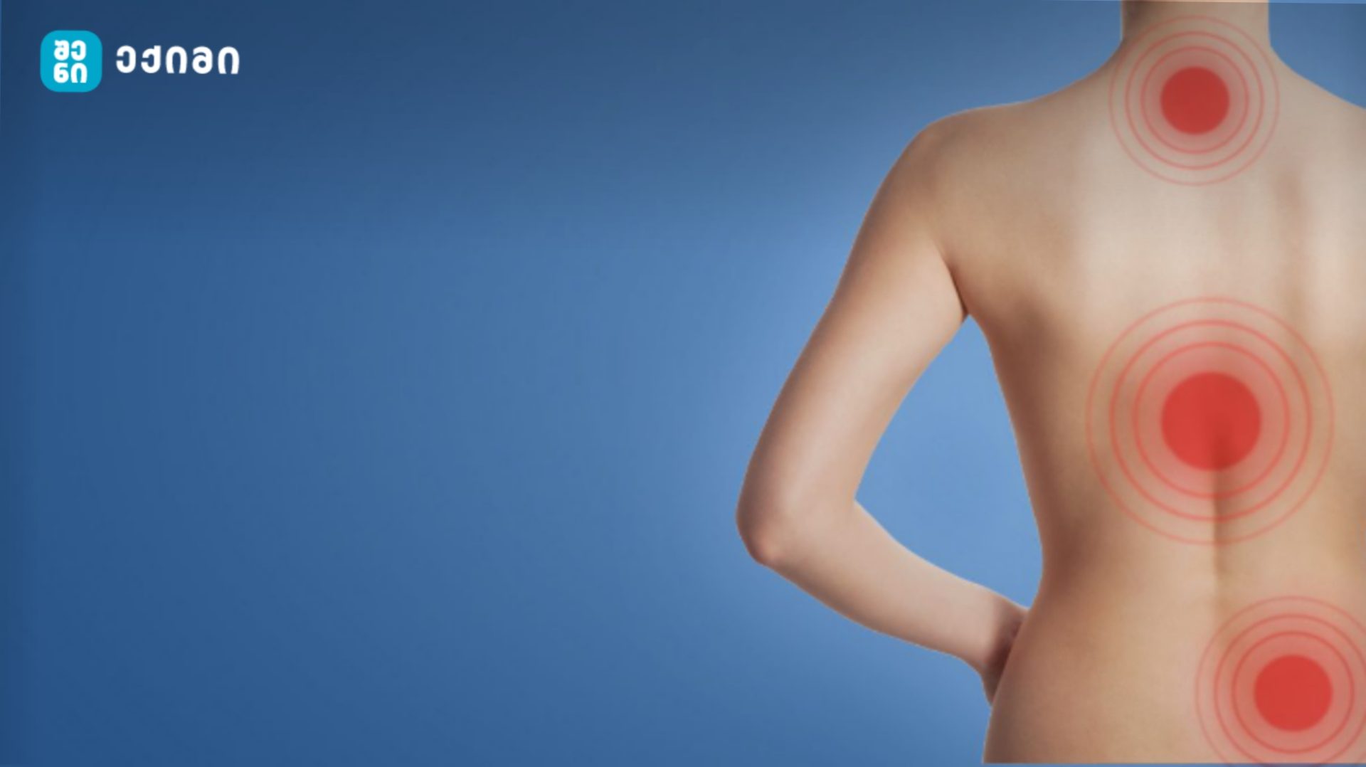 shenirqimi zurgis tkivili