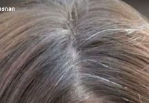 კვლევა: ჭაღარა თმა შესაძლოა მხოლოდ დაბერებასთან არ იყოს დაკავშირებული – შესაძლოა ასახავდეს დამცავ პროცესს რომელი მინერალის ნაკლებობა შეიძლება გქონდეთ, თუ ნაადრევად გაჭაღარავდით