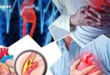 „სამწუხაროდ, მისი ასაკი თანდათან ახალგაზრდავდება“ – “პრობლემა ძალიან სერიოზულია, თუმცა არის ძალიან მარტივად აღმოჩენადი” აიცილე თავიდან ინფარქტი და ინსულტი – აკონტროლე წნევა