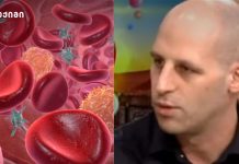 თუ კანზე გამოხატული ეს სიმპტომები გაქვთ, ორგანიზმი მომატებულ ქოლესტერინის დონეზე მიგვანიშნებს რატომ ეძახიან ექიმები ქოლესტერინს "ჩუმ მკვლელს" - მნიშვნელოვანია მისი კონტროლი და მკურნალობა დროულად