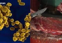 ბრუცელოზი თბილისში – „სწრაფი რეაგირებაა საჭირო“ ბრუცელოზი საქართველოში გავრცელებული ინფექციური დაავადებაა, რომელიც ადამიანს გადაეცემა ცხოველიდან