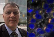 კიბოს განვითარება: მარტივად ახსნილი რთული პროცესი კიბოს მკურნალობაში რევოლუციური გარღვევა – ახალი იმედი!