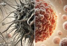 უახლესი სამეცნიერო აღმოჩენა – კიბოს მეტასტაზები უხილავი ბუშტუკებით ვრცელდება —მათი შეჩერების შესაძლო მეთოდს მიაგნეს კიბოს უჯრედების ნორმალურ მდგომარეობაში დაბრუნება – სამედიცინო გარღვევა!