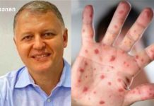 წითელა 25-წლიან მაქსიმუმზეა — ეს უკვე გლობალური კრიზისია და საფრთხე საქართველოზეც ვრცელდება ტეხასში წითელას აფეთქებ