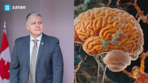 ახალი კვლევა:  ეს იქნება ძალზე მნიშვნელოვანი ნაბიჯი დემენციის პრევენციის მიმართულებით – რა არის მეხსიერების დაქვეითების ადრეული ნიშანი?