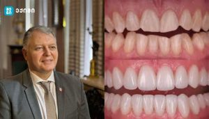 რა საერთო აქვთ კარიესს და გულის შეტევას? – კბილების გაფუჭება გულს აზიანებს — და შეიძლება სიცოცხლისთვის საფრთხეც იყოს
