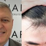 თმის ცვენა – მარტო კოსმეტიკური პრობლემა არ არის… და მას შეიძლება ბუნებრივადაც ვუშველოთ